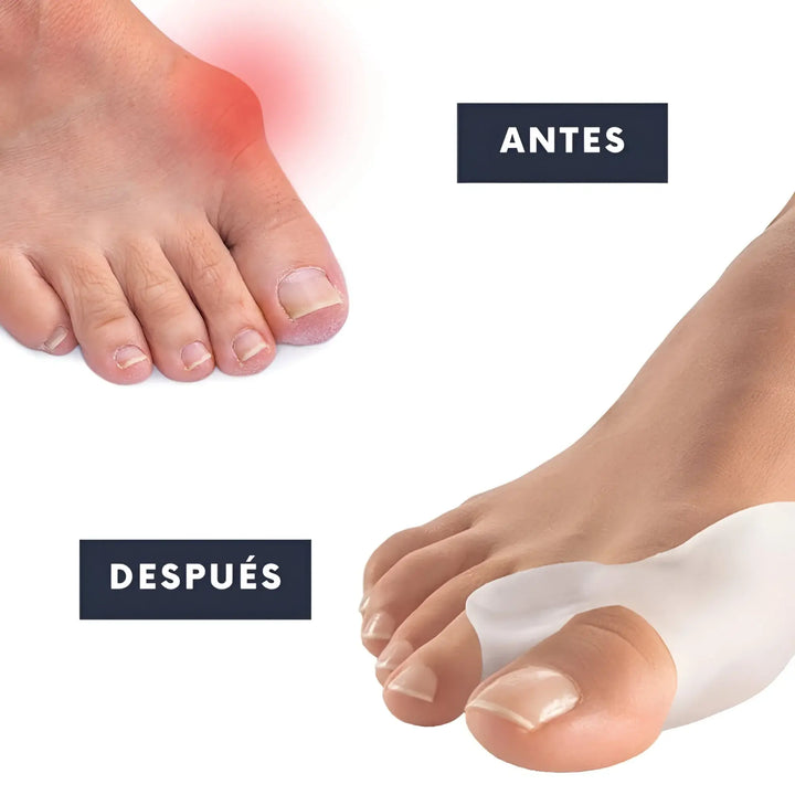 Correcto Para Dedos del Pie en Silicona en  amazon